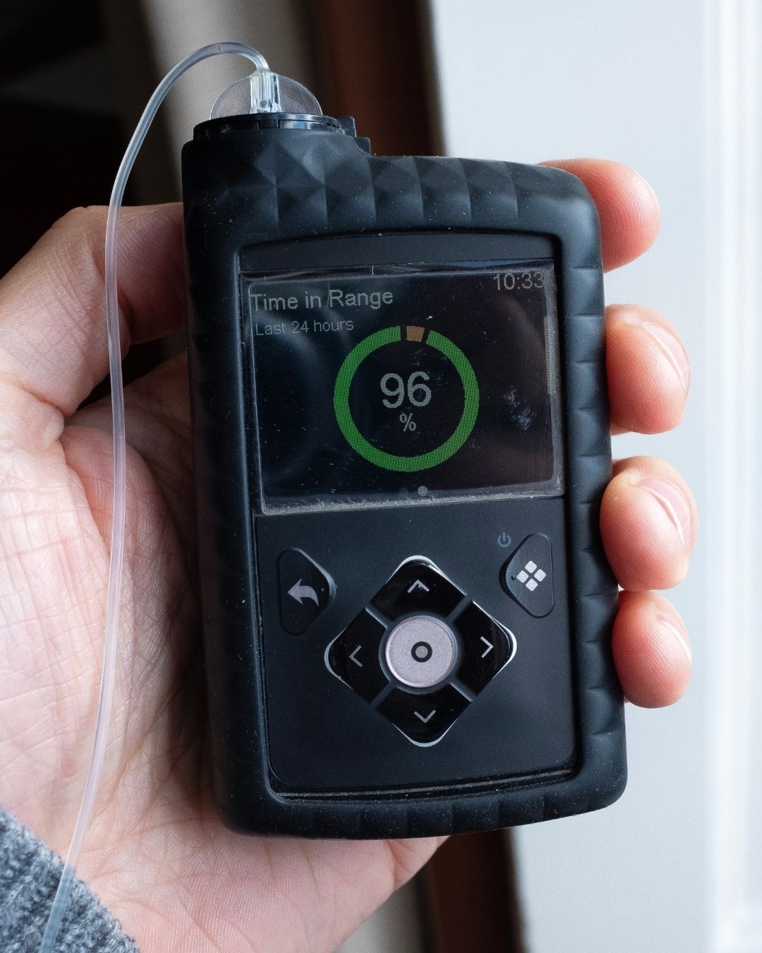 Hand holding an insulin pump showing glucose reading