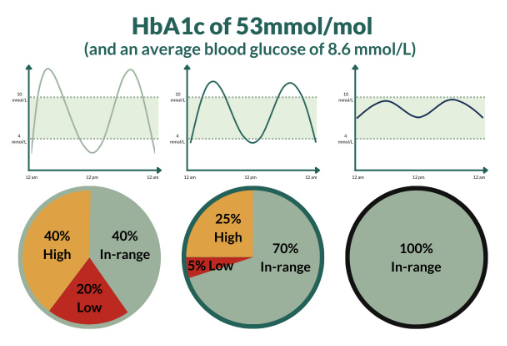 Shows 3 examples of different people whose average blood glucose is the same at 8.6 mmol/L.The first  graph shows the person has a rollercoaster of dangerous highs and lows, the second still has highs and lows but much less pronounced and more time in range, the third has little variability and spends all the time in range.